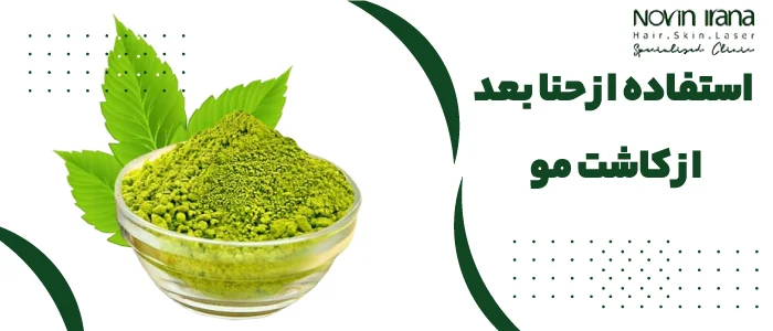 استفاده از حنا بعد از کاشت مو